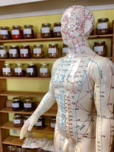 Acupuncture treatment for migraines