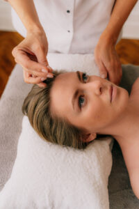 acupuncture